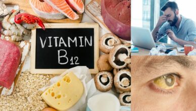 7 Anzeichen, dass du einen Vitamin B12-Mangel haben könntest