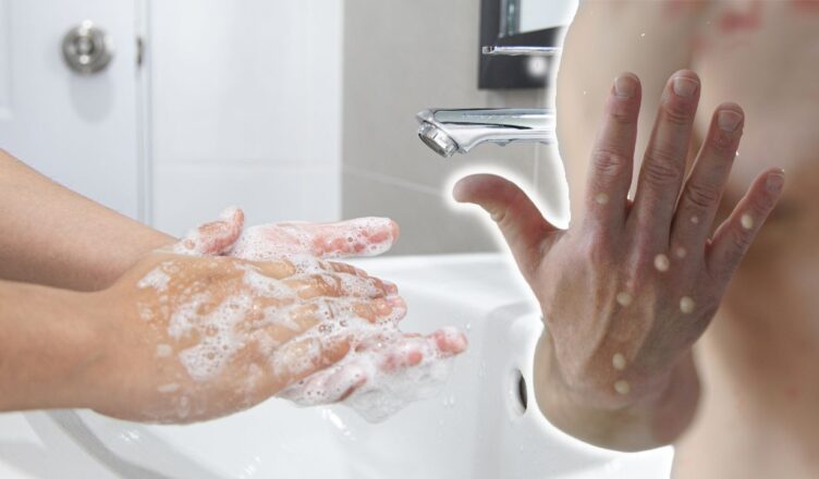 Diese 5 Fehler solltest du niemals beim Händewaschen machen