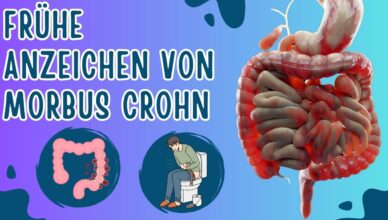 10 Frühe Anzeichen von Morbus Crohn, die du kennen musst