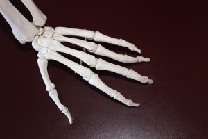 Mehr über den Artikel erfahren Arthritis – durch sanfte Behandlungsmethoden Schmerzen lindern