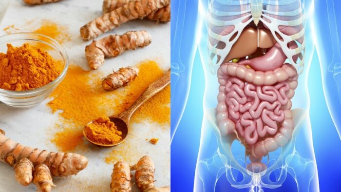 Du betrachtest gerade Studie belegt die Vorteile von Curcumin für den Magen-Darm-Trakt