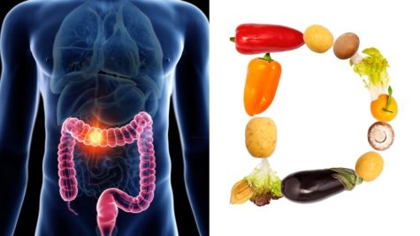 Du betrachtest gerade Studie: Vitamin D-Mangel kann das Darmkrebsrisiko erhöhen