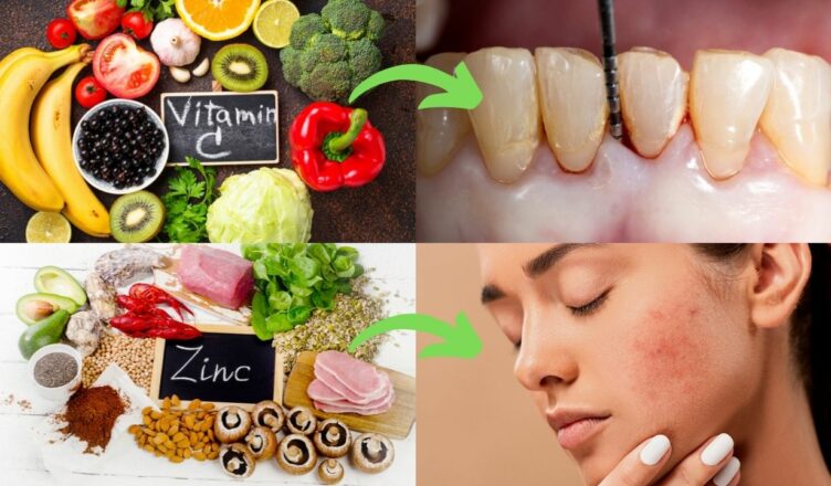 7 Symptome, die auf einen Vitaminmangel hindeuten