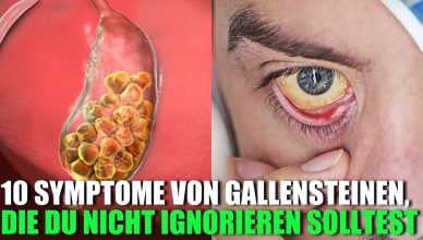 10 Symptome von Gallensteinen, die du nicht ignorieren solltest