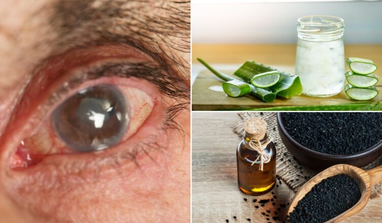 10 natürliche Hausmittel gegen Glaukom