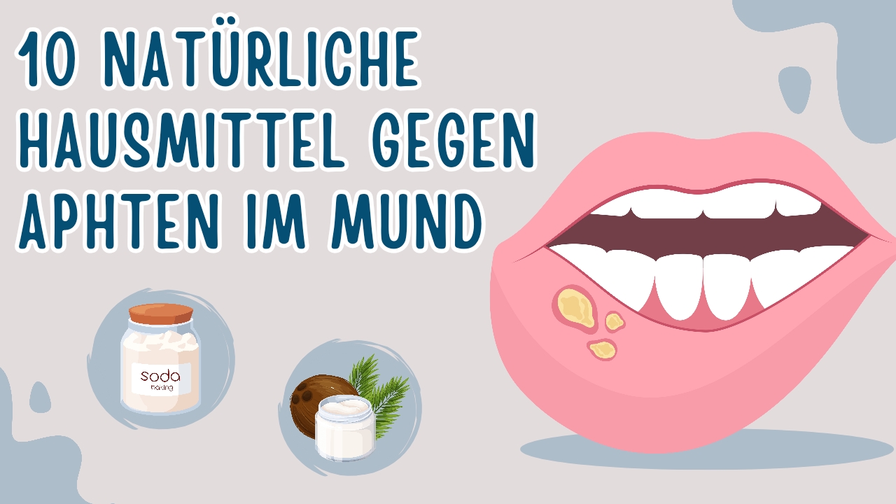 Du betrachtest gerade 10 Natürliche Hausmittel gegen Aphten im Mund