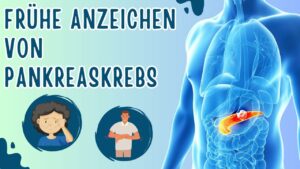 Mehr über den Artikel erfahren 10 Frühe Anzeichen von Bauchspeicheldrüsenkrebs, die du nicht ignorieren solltest